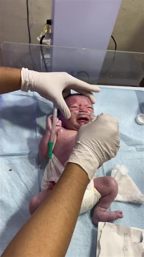 Gentle Newborn Care: Cleaning & Suctioning Baby After Birth