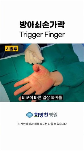 [#TriggerFinger] Troubled thumb, the transformation process after stage-specific treatment