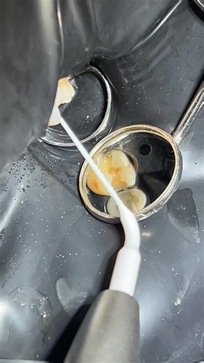 Comprehensive Guide to Endodontics for Dental Students