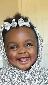 1K views | Finding the right products for your baby’s eczema can be...