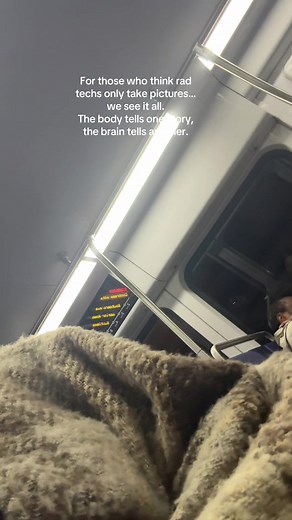 I’m still early in my rad tech journey, but the more I learn, the more I realize how versatile we really are. People forget radiology plays a part in the mental health space too from brain imaging to trauma and neuro work. The world is shifting toward mental health technology, and rad techs are right in the middle of it. #radtechstudent #radiologytech #healthcaredebate #mentalhealthawareness