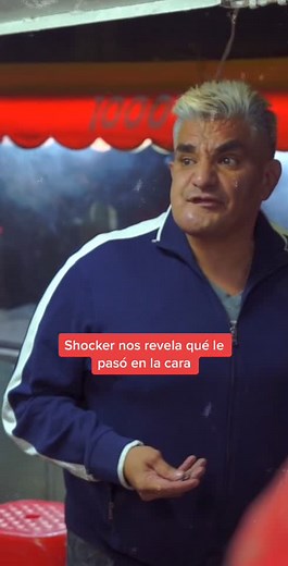 ¿Qué le pasó en la cara a Shocker? Impactantes revelaciones