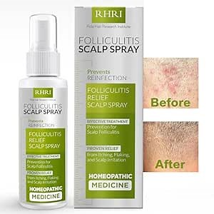 Folliculitis Scalp Spray | Dandruff Treatment for Psoriasis & Folliculitis | Antifungal & Anti Dandruff Itchy Scalp Treatment Formula Spray for Dry and Irritated Scalp