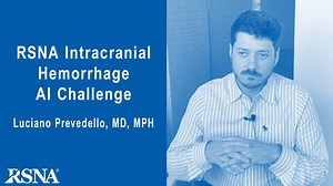Luciano Prevedello, MD, MPH discusses the 2019 RSNA Intracranial Hemorrhage AI Challenge: Read more in RSNA News: http://bit.ly/2kjDvu4 Register for the challenge: http://bit.ly/2mi7PGq | Radiological Society of North America (RSNA)