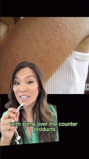 If you have stubborn bumps on your arms or legs 🍓