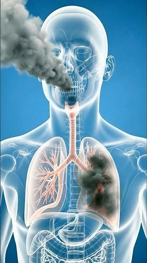 What happens when you breathe PM 2.5 everyday?