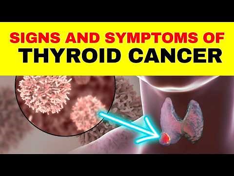 5 Important Signs and Symptoms of Thyroid Cancer That You Shouldn't Ignore