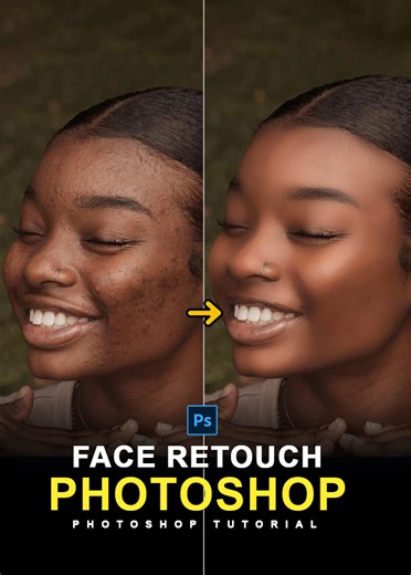 High-end Skin Retouching Tutorial in Adobe Photoshop | Photoshop #shorts Tutorial #highendretouching #skinretouch #faceretouch #beautyretouch #pimpleremove #photoshoptutorial #graphicssolutiontricks #photoshop | Graphics Solution Tricks