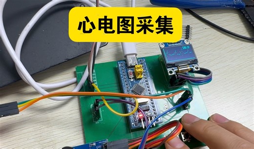 心电图采集，STM32采集AD8232心电图，EEG OLED显示波形！