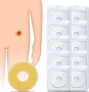 10PCS Ostomy Barrier Rings, Moldable Adapt Barrier Rings, Hydrocolloid Skin Extender Rings RLOVAL Ostomy Supplies for Colostomy Bags, Outer Diameter: 2" (48mm)
