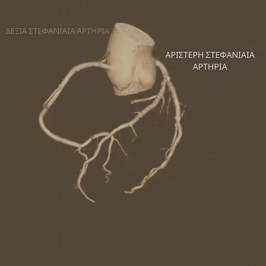 Αξονική Στεφανιογραφία - Όμιλος Ιατρόπολις