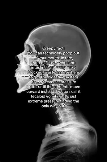 Most of the time, your digestive system works quietly and predictably, but in extreme cases, a complete blockage can force waste upward, coming out as vomit. The body always finds a way. #humanbody #fyppppppppppppppppppppppp #creepy #sciencefacts #humanbodyfacts