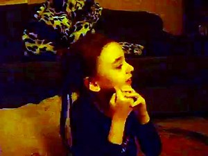 Typical Rett Syndrome Hand Wringing