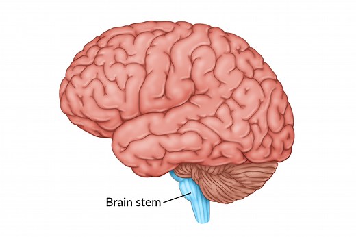 Brain Stem Stroke: What to Expect for Recovery and Rehabilitation - Home Recovery for Stroke, Brain Injury and More