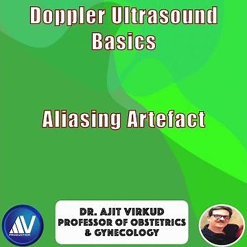 “Why Your Doppler Waveform Flips: Aliasing Explained in 30 Seconds”