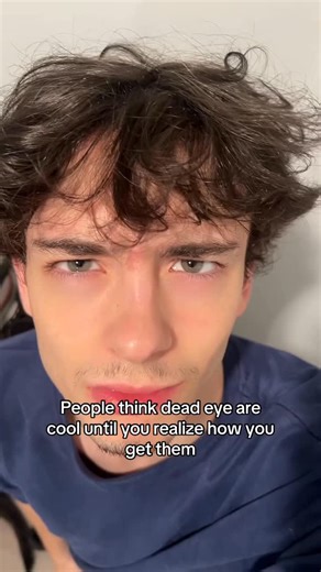 Ethen Arsenault on Instagram: "Dead eyes cool until you realize #reels #viral #explore #tiktok #fyp #eyes #deadeyes #sleepy eyes"