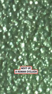 5.7K views · 26 reactions | Body parts: Under The Microscope 勞 | LADbible New Zealand | Facebook