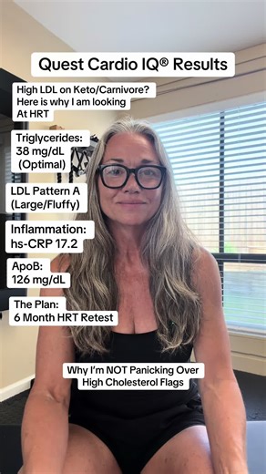 Quest Cardio IQ® Results: The Skeptical Researcher’s Deep Dive 🔬 Most people see