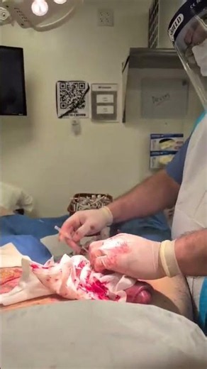 What Happens During a Shaft & Glands Augmentation? #medical #procedure