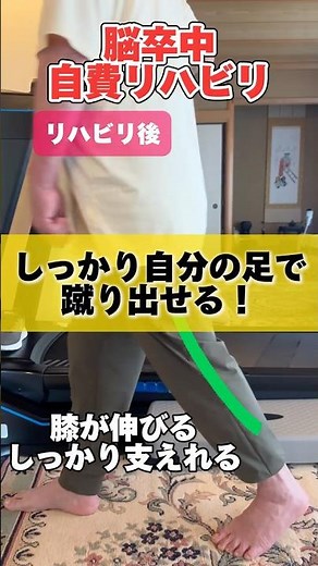 【脳卒中】立脚期で膝が曲がる原因とは？歩行の変化をご紹介｜理学療法士が解説