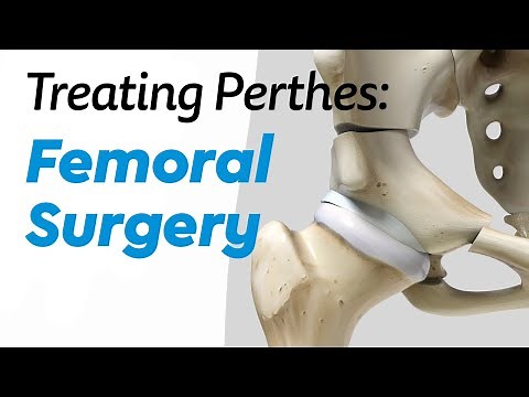 Femoral Surgery for Treating Perthes Disease in Children
