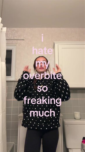 🫩🫩🫩🫩 #overbite #relatable #fyp #viral #repost | over bite smile