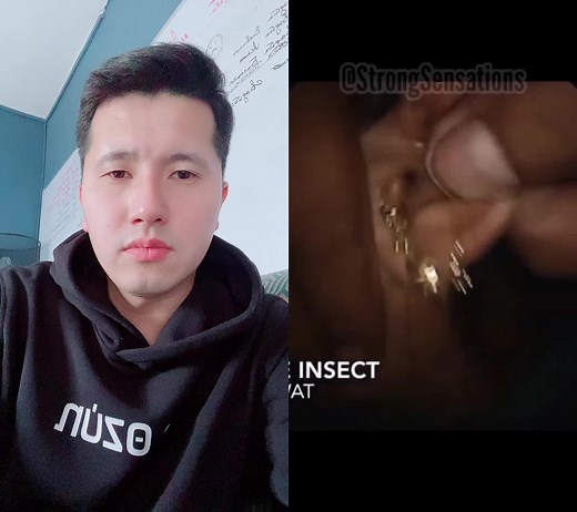 Insect Infestation in Human Ear Explored