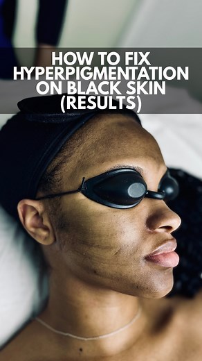 23K views · 39 reactions | UPDATE VIDEO HOW TO FIX...