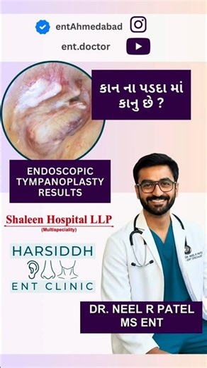 Endoscopic Tympanoplasty Testimonial | Eardrum Hole Repair | Dr. Neel Patel ENT Ahmedabad