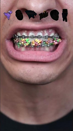 Always practice safe snacks 😅