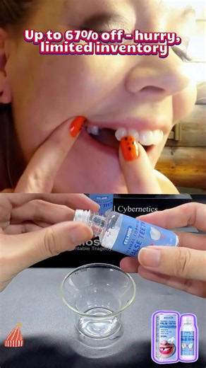 Moldable Dental Gel: Fix Your Chipped or Missing Tooth in 60 Seconds
