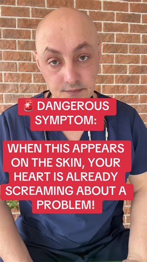 Dangerous Skin Signs for Heart Health