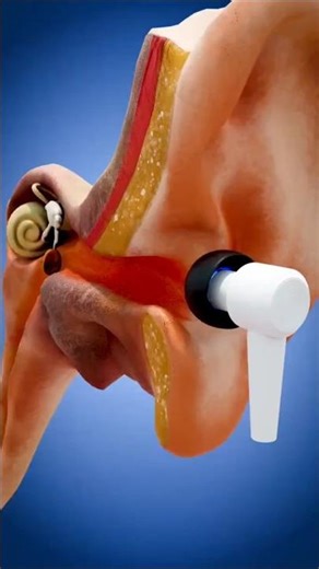 Earbuds can damage your ear #facts #3d animation #science