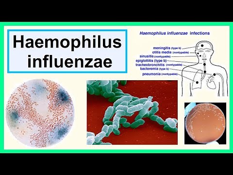 Haemophilus influenzae
