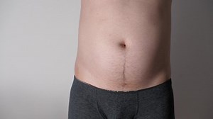 Man jumps and shakes his big belly. Close up of fat man shaking his stomach. Adult play with his fat belly. Overeating. Risk of diabetes. Weight loss or weight gain during quarantine. Bodypositive