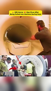 MRI Horror 💔 Man Di.es After Being Pulled Into Machine During Scan...Full in comment🚛😀😃 | Spotlight US News Fan