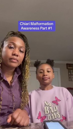 Chiari Malformation Awareness #1 #chiarimalformation #fyp