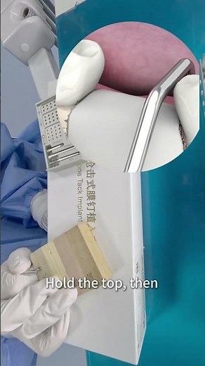 Lingual Bone Tack Holder & Bone Screw Kit | GBR Membrane Fixation Demo