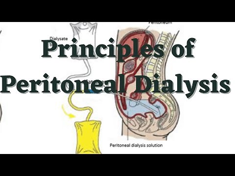 Principles of Peritoneal Dialysis/Peritoneal dialysis/Diffusion Osmosis, ultrafiltration of dialysis