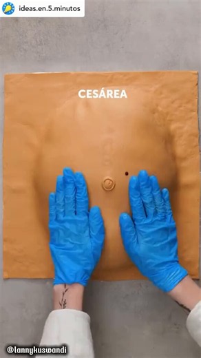 This is how birth by c section works Womwn deserve so much respect.