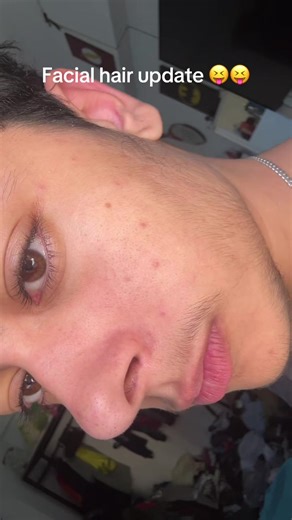 8-Month Facial Hair Update: My Transformation Journey