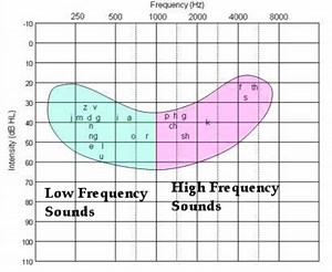 The Best Hearing Loss Simulations: Understanding Audiograms and the Impact of the Speech Banana