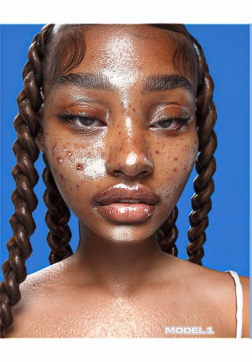 Acne Solutions for The Sims 4 - New Models and Tiers