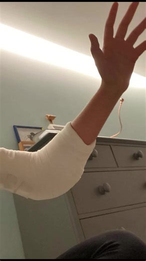 Desde que tengo memoria, nunca he podido estirar el brazo derecho por completo. Durante toda mi infancia no le di mucha importancia pero mientras iba creciendo la gente lo mencionaba más y por más que para mí no era algo que me quitara el sueño, tampoco me gustaba que fuera tan obvio. Y no lo era, las personas que conocía podían pasar semanas o hasta meses en darse cuenta que tenía ese problema, ya fuera por la cicatriz o porque siempre llegaba el momento en el que yo lo mencionaba, muy pocas ve