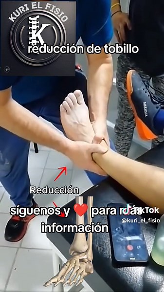 Cómo reconocer y tratar una luxación de tobillo