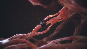 Cancer Animation - Kacper Zulinski
