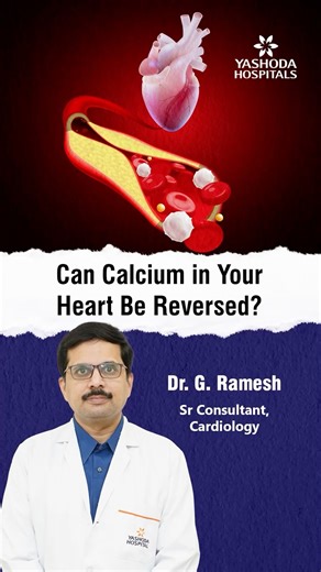 Calcium in Your Heart: Can It Be Reversed? – Dr. G. Ramesh