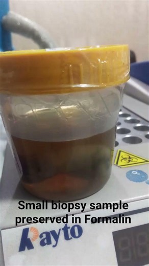 #Appendix Small biopsy sample preserved in Formalin/#new/#trending