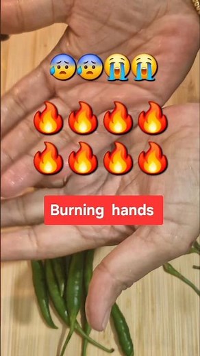 🔥 Burning Hands After Cutting Chillies? Try These Instant Home Remedies!#Kitchen Hack #homeremedies
