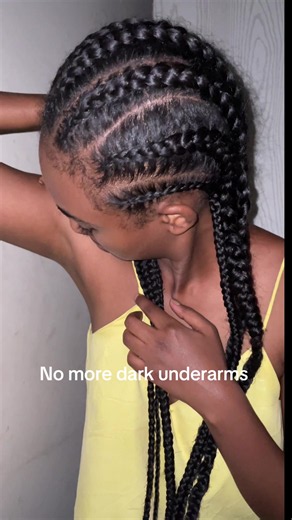 Get Rid of Dark Underarms: A Simple Organic Remedy